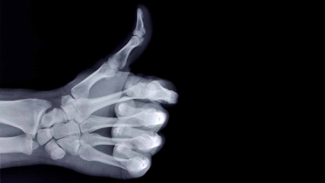 Facts About X-rays In Marathi